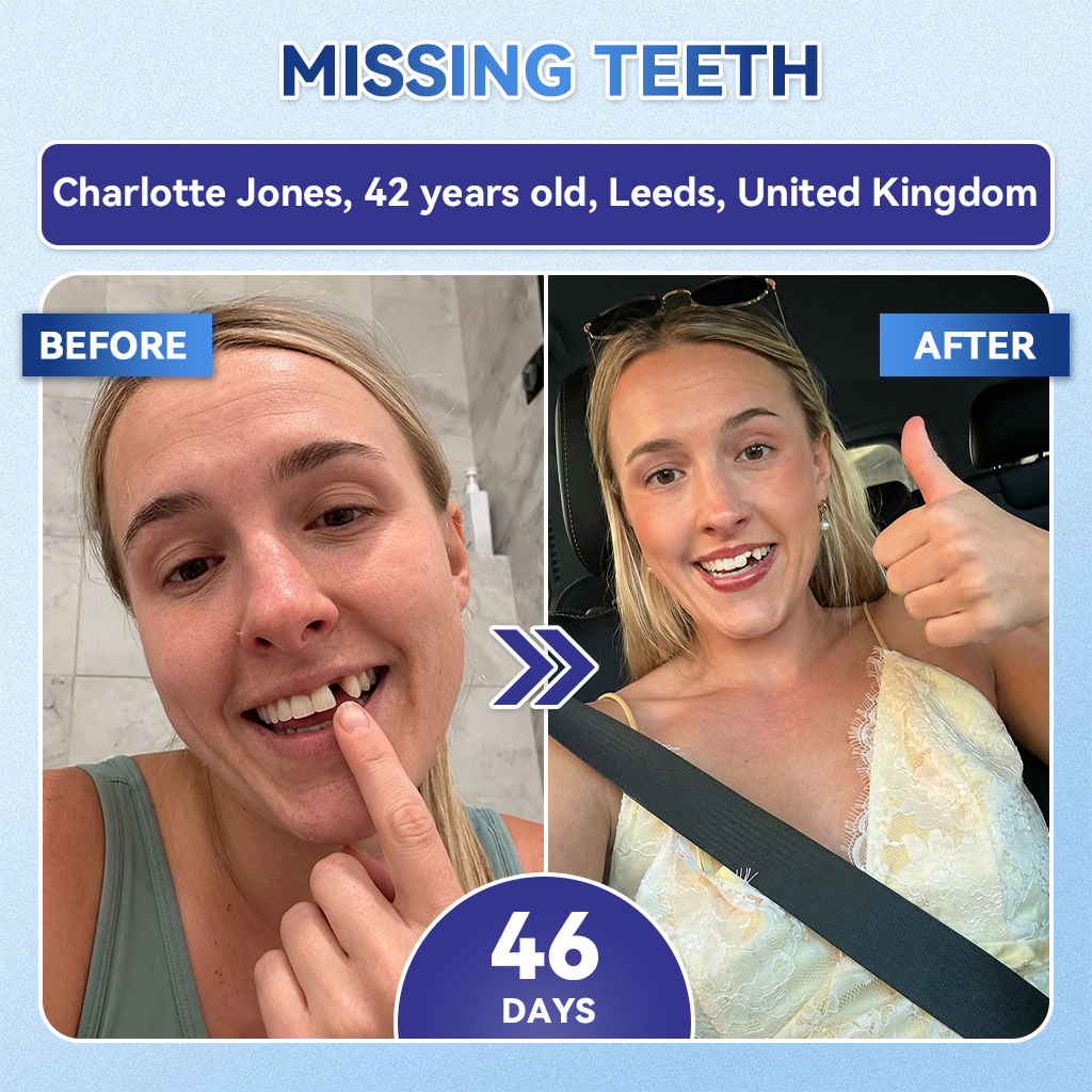 🦷𝐆𝐥𝐢𝐦𝐦𝐞𝐫𝐥𝐲® 🎟️𝐓𝐢𝐝𝐞𝐠𝐥𝐮𝐬𝐢𝐛 𝐓𝐨𝐨𝐭𝐡 & 𝐆𝐮𝐦 𝐑𝐞𝐩𝐚𝐢𝐫 𝐌𝐢𝐜𝐫𝐨𝐧𝐞𝐞𝐝𝐥𝐞 𝐏𝐚𝐭𝐜𝐡  | 𝐀𝐝𝐯𝐚𝐧𝐜𝐞𝐝 𝐒𝐭𝐞𝐦-𝐂𝐞𝐥𝐥 𝐀𝐜𝐭𝐢𝐯𝐚𝐭𝐢𝐨𝐧 𝐓𝐞𝐞𝐭𝐡 𝐒𝐭𝐫𝐢𝐩𝐬(🦷𝐑𝐞𝐛𝐮𝐢𝐥𝐝 𝐄𝐧𝐚𝐦𝐞𝐥 & 𝐃𝐞𝐧𝐭𝐢𝐧 • 𝐒𝐭𝐫𝐞𝐧𝐠𝐭𝐡𝐞𝐧 𝐆𝐮𝐦𝐬 • 𝐄𝐫𝐚𝐝𝐢𝐜𝐚𝐭𝐞 𝐓𝐚𝐫𝐭𝐚𝐫 & 𝐎𝐝𝐨𝐫 • 𝐒𝐭𝐨𝐩 𝐓𝐨𝐨𝐭𝐡 𝐒𝐞𝐧𝐬𝐢𝐭𝐢𝐯𝐢𝐭𝐲)