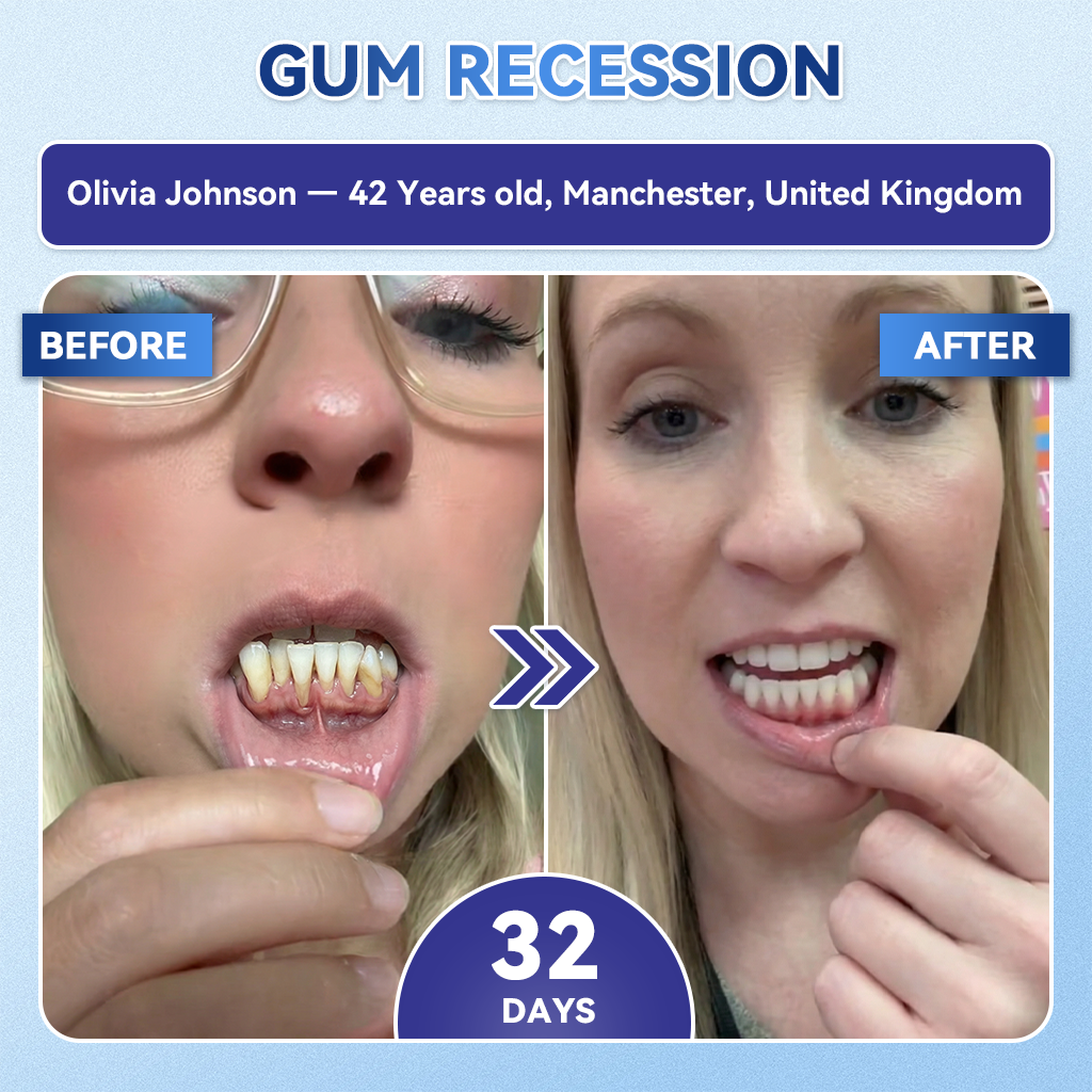 🦷𝐆𝐥𝐢𝐦𝐦𝐞𝐫𝐥𝐲® 🎟️𝐓𝐢𝐝𝐞𝐠𝐥𝐮𝐬𝐢𝐛 𝐓𝐨𝐨𝐭𝐡 & 𝐆𝐮𝐦 𝐑𝐞𝐩𝐚𝐢𝐫 𝐌𝐢𝐜𝐫𝐨𝐧𝐞𝐞𝐝𝐥𝐞 𝐏𝐚𝐭𝐜𝐡  | 𝐀𝐝𝐯𝐚𝐧𝐜𝐞𝐝 𝐒𝐭𝐞𝐦-𝐂𝐞𝐥𝐥 𝐀𝐜𝐭𝐢𝐯𝐚𝐭𝐢𝐨𝐧 𝐓𝐞𝐞𝐭𝐡 𝐒𝐭𝐫𝐢𝐩𝐬(🦷𝐑𝐞𝐛𝐮𝐢𝐥𝐝 𝐄𝐧𝐚𝐦𝐞𝐥 & 𝐃𝐞𝐧𝐭𝐢𝐧 • 𝐒𝐭𝐫𝐞𝐧𝐠𝐭𝐡𝐞𝐧 𝐆𝐮𝐦𝐬 • 𝐄𝐫𝐚𝐝𝐢𝐜𝐚𝐭𝐞 𝐓𝐚𝐫𝐭𝐚𝐫 & 𝐎𝐝𝐨𝐫 • 𝐒𝐭𝐨𝐩 𝐓𝐨𝐨𝐭𝐡 𝐒𝐞𝐧𝐬𝐢𝐭𝐢𝐯𝐢𝐭𝐲)