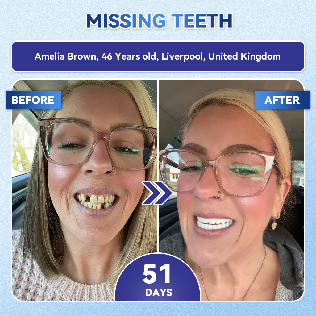 🦷𝐆𝐥𝐢𝐦𝐦𝐞𝐫𝐥𝐲® 🎟️𝐓𝐢𝐝𝐞𝐠𝐥𝐮𝐬𝐢𝐛 𝐓𝐨𝐨𝐭𝐡 & 𝐆𝐮𝐦 𝐑𝐞𝐩𝐚𝐢𝐫 𝐌𝐢𝐜𝐫𝐨𝐧𝐞𝐞𝐝𝐥𝐞 𝐏𝐚𝐭𝐜𝐡  | 𝐀𝐝𝐯𝐚𝐧𝐜𝐞𝐝 𝐒𝐭𝐞𝐦-𝐂𝐞𝐥𝐥 𝐀𝐜𝐭𝐢𝐯𝐚𝐭𝐢𝐨𝐧 𝐓𝐞𝐞𝐭𝐡 𝐒𝐭𝐫𝐢𝐩𝐬(🦷𝐑𝐞𝐛𝐮𝐢𝐥𝐝 𝐄𝐧𝐚𝐦𝐞𝐥 & 𝐃𝐞𝐧𝐭𝐢𝐧 • 𝐒𝐭𝐫𝐞𝐧𝐠𝐭𝐡𝐞𝐧 𝐆𝐮𝐦𝐬 • 𝐄𝐫𝐚𝐝𝐢𝐜𝐚𝐭𝐞 𝐓𝐚𝐫𝐭𝐚𝐫 & 𝐎𝐝𝐨𝐫 • 𝐒𝐭𝐨𝐩 𝐓𝐨𝐨𝐭𝐡 𝐒𝐞𝐧𝐬𝐢𝐭𝐢𝐯𝐢𝐭𝐲)