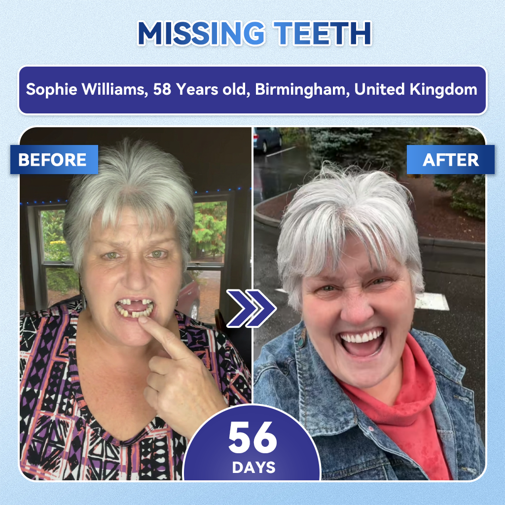 🦷𝐆𝐥𝐢𝐦𝐦𝐞𝐫𝐥𝐲® 🎟️𝐓𝐢𝐝𝐞𝐠𝐥𝐮𝐬𝐢𝐛 𝐓𝐨𝐨𝐭𝐡 & 𝐆𝐮𝐦 𝐑𝐞𝐩𝐚𝐢𝐫 𝐌𝐢𝐜𝐫𝐨𝐧𝐞𝐞𝐝𝐥𝐞 𝐏𝐚𝐭𝐜𝐡  | 𝐀𝐝𝐯𝐚𝐧𝐜𝐞𝐝 𝐒𝐭𝐞𝐦-𝐂𝐞𝐥𝐥 𝐀𝐜𝐭𝐢𝐯𝐚𝐭𝐢𝐨𝐧 𝐓𝐞𝐞𝐭𝐡 𝐒𝐭𝐫𝐢𝐩𝐬(🦷𝐑𝐞𝐛𝐮𝐢𝐥𝐝 𝐄𝐧𝐚𝐦𝐞𝐥 & 𝐃𝐞𝐧𝐭𝐢𝐧 • 𝐒𝐭𝐫𝐞𝐧𝐠𝐭𝐡𝐞𝐧 𝐆𝐮𝐦𝐬 • 𝐄𝐫𝐚𝐝𝐢𝐜𝐚𝐭𝐞 𝐓𝐚𝐫𝐭𝐚𝐫 & 𝐎𝐝𝐨𝐫 • 𝐒𝐭𝐨𝐩 𝐓𝐨𝐨𝐭𝐡 𝐒𝐞𝐧𝐬𝐢𝐭𝐢𝐯𝐢𝐭𝐲)