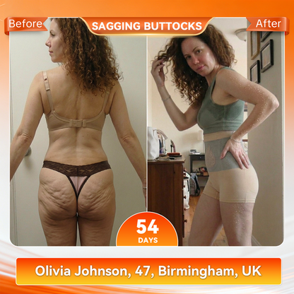 🧧🎈PAURAJU® 30-Min All-in-One Micro-Particle Fat-Burning Shorts✅Ignites deep microcirculation to melt fat, flush toxins, and reverse metabolic aging.